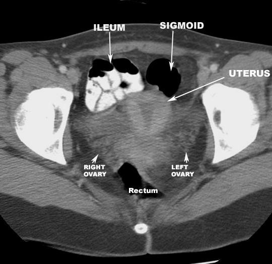 Pelvic Anatomy