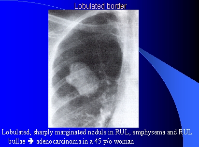 slide 53 next previous