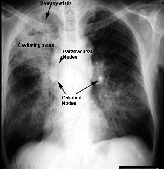 See labeled film below.