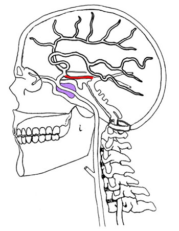 Cervical Carotid