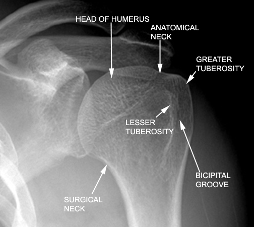 Identify the various parts seen. Click the image for labeling.