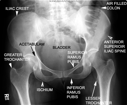 Identify the pelvic bones and joints. Click the image for labeling.