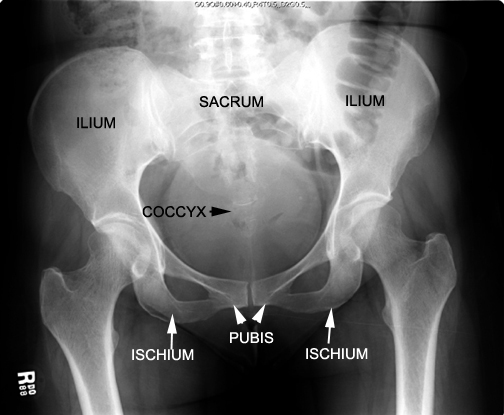 Identify the pelvic bones. Click the image for labeling.