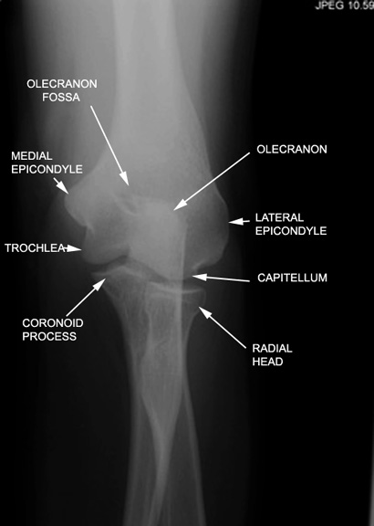 identify the parts seen click the image for labeling