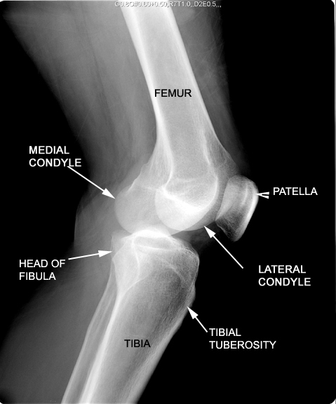 identify the structures seen click the image for labeling